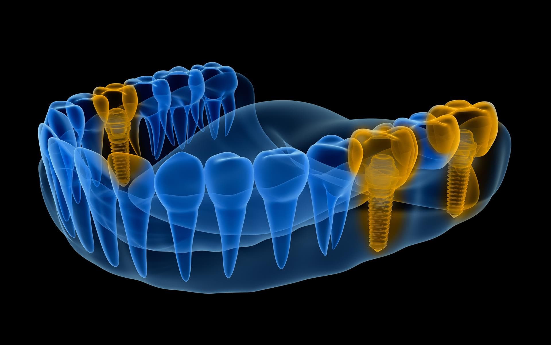 Tecnologías Cad-cam